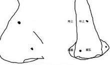 男人鼻子上长痣命运如何