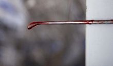 梦见流产意味着什么