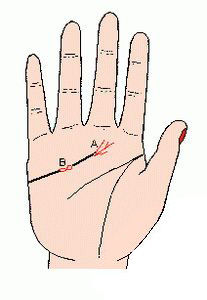 手垂体线图5