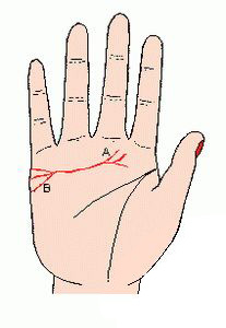 手垂体线图3
