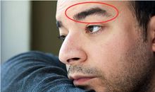 2018年财运出色能够发财的人有哪些痣相?