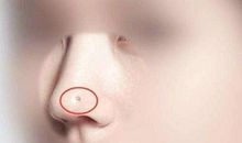 最贵的痣有哪些