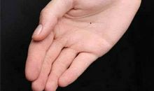 手掌心有痣代表什么