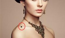 最应该祛除的五个恶痣介绍 了解痣的位置