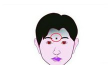 哪些痣留不得?常见的凶痣运势象征分析