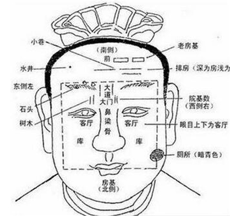 桑切特征