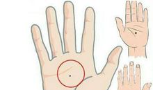 痣相分析：手中长有痣有着哪些含义特征?