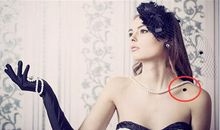 身上长恶痣怎么办?教你正确的化解方法