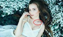 郑博士：从痣相看运势