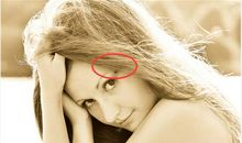 女性眼睛周围有痣是好是坏?注意痣的位置