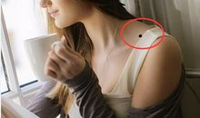 恶痣如何化解?揭示恶痣的位置