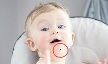 哪些孩子有出息?从痣相特征来看