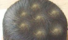 头上几个旋代表什么