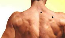 哪些痣不能点掉图解