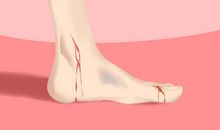 梦到家人受伤有什么征兆