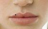女性唇部有痣的含义
