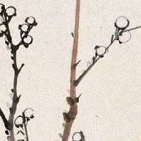 女人脸上十大吉痣 眼睛四周长痣可能一夜暴富