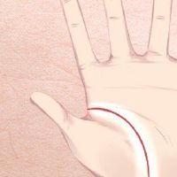 双手假断掌的女人 婚姻幸福子女康顺