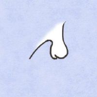 女人的胳膊痰与光明磊分析胳膊肘关节