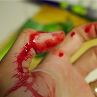 你梦见了什么手和伤害？