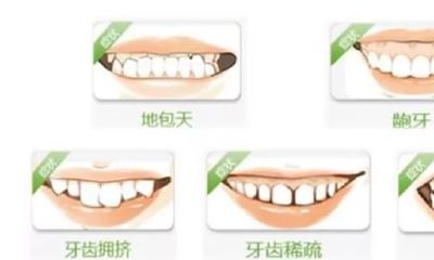 如何使用牙齿观察法来预测个人运势的好坏程度？