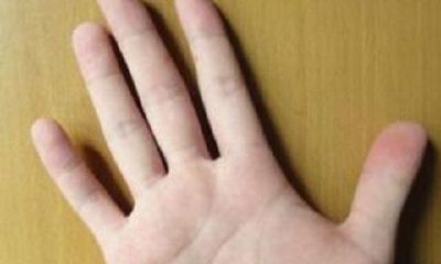 梦到手里有一个洞