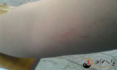 梦到手上长了较长的头发