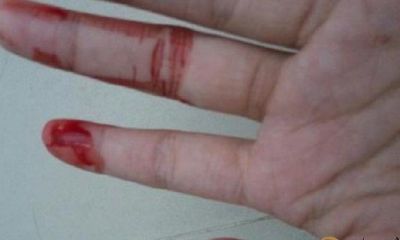 梦到自己右手出了许多 血