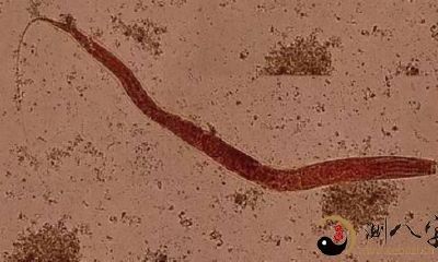 梦到从人体里拽出小虫子