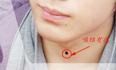 喉结有痣表示什么