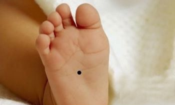 决定成败的五颗好痣！你有吗？