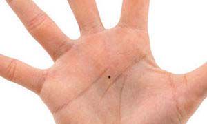 N种吉凶痣 教你从头数到脚