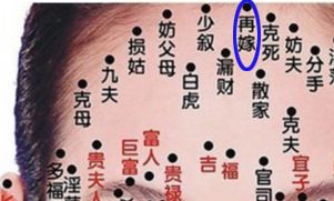 只要痣上长毛不管在哪都好吗，有什么说法？