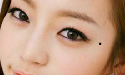 眼痣的位置与命运图 眼痣痣相分析