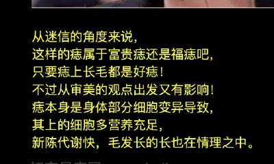 左脸有痣痣上长毛很坏吗？