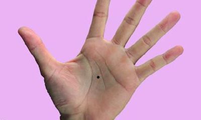 手掌痣的位置与命运，掌心有痣图解