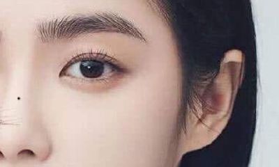 鼻子上有痣好不好，鼻子长痣面相图解
