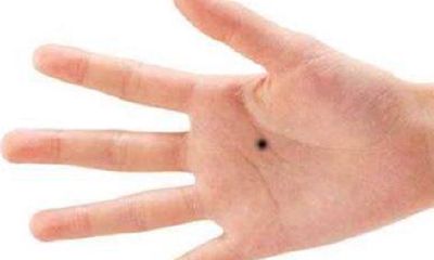 手痣的位置与命运图