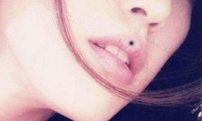 面相长痣谨防健康晦气