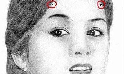 额头上长了凶痣如何化解？