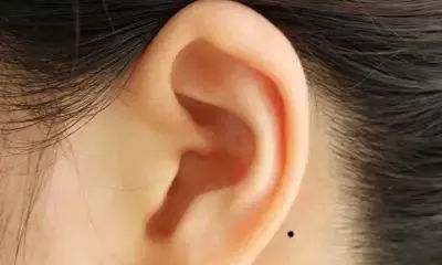 耳朵后长痣多为小人