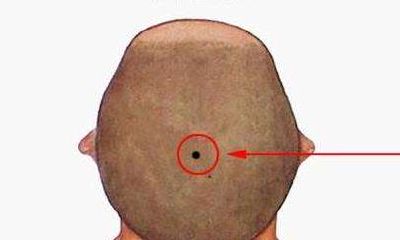 身上痣的位置与命运图解_痣相解人生