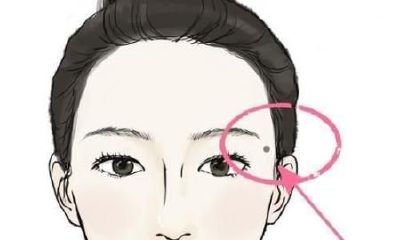 看看你身上有多少幸运痣