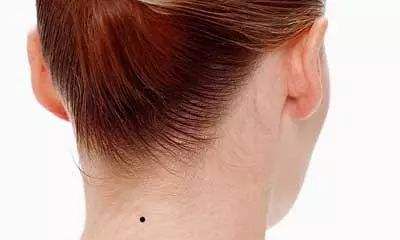 脖子后面的是苦情痣，脖子后面有痣的人好吗？