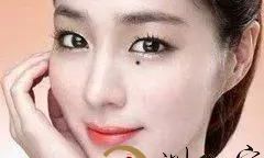 哪些痣代表着你的工作财气会变好?