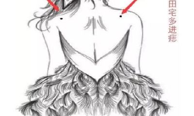 痣相：长在后背的六大富痣