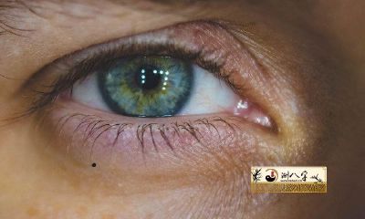 女性眼痣图解大全