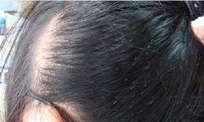 梦到掉许多 秀发