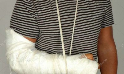 梦见儿子胳膊断掉