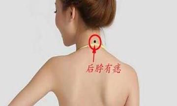 身上长的痣到底有哪些寓意？